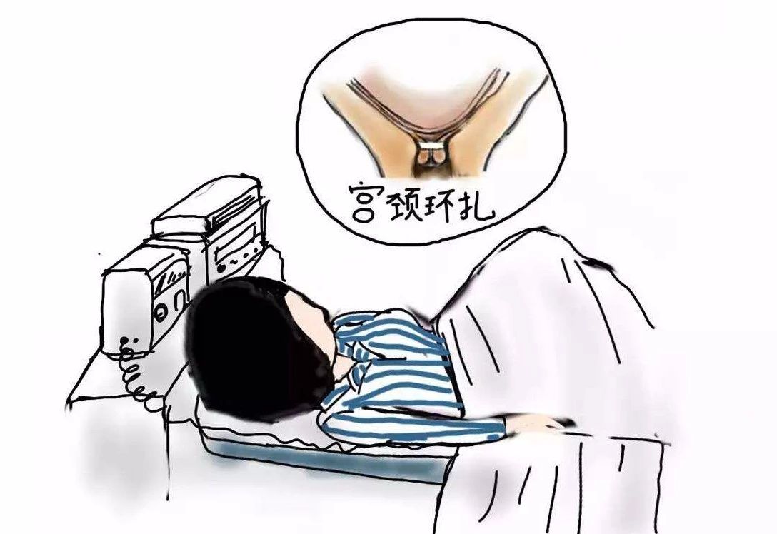 子宫扩张器有什么用宫颈机能不全导致多次流产，腹腔镜下宫颈环扎术为您保驾护航_https://www.jmylbn.com_新闻资讯_第4张